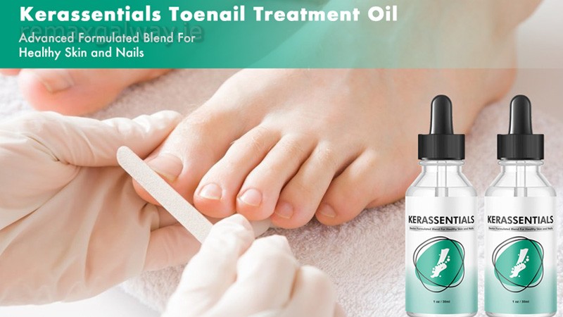 Kerassentials Use Case Illustration